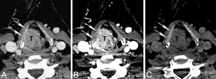 Fig 4.