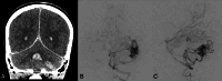 FIG 2.