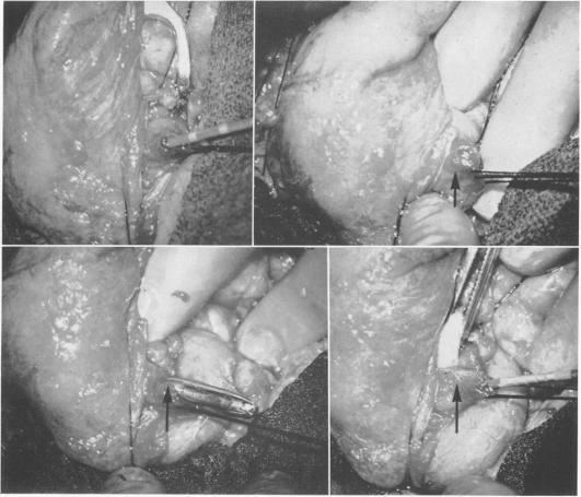 Fig. 1., Fig. 2., Fig. 3., Fig. 4.