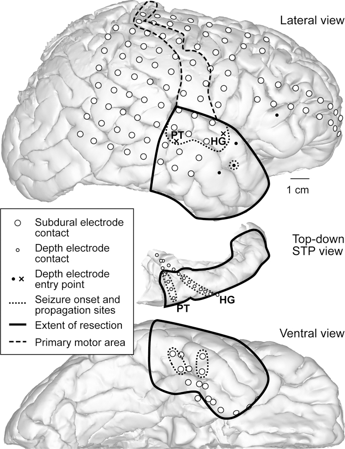 FIG. 6.