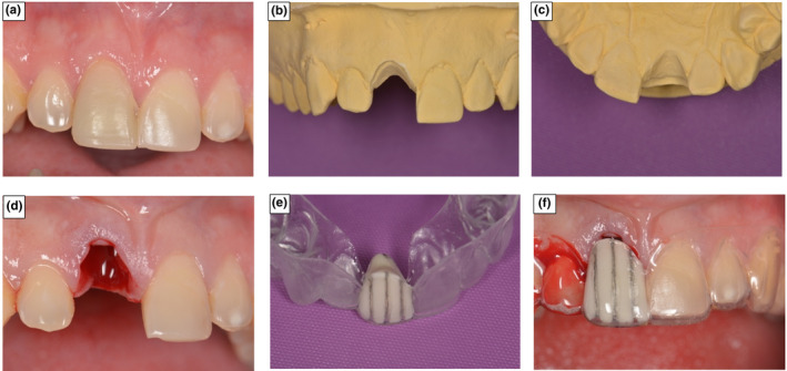 FIGURE 4