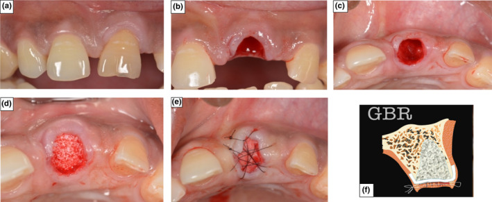 FIGURE 1