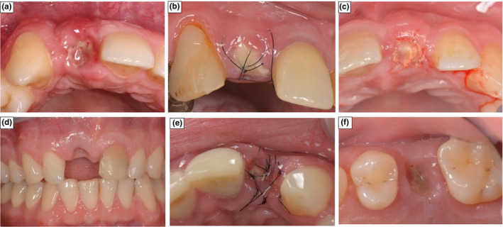 FIGURE 12