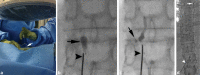 Fig. 5