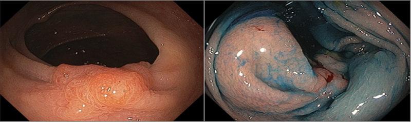 Figure 3: