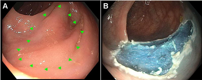 Figure 2: