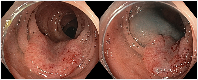 Figure 4: