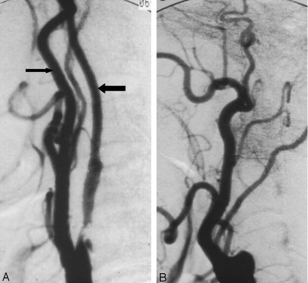 Fig 3.