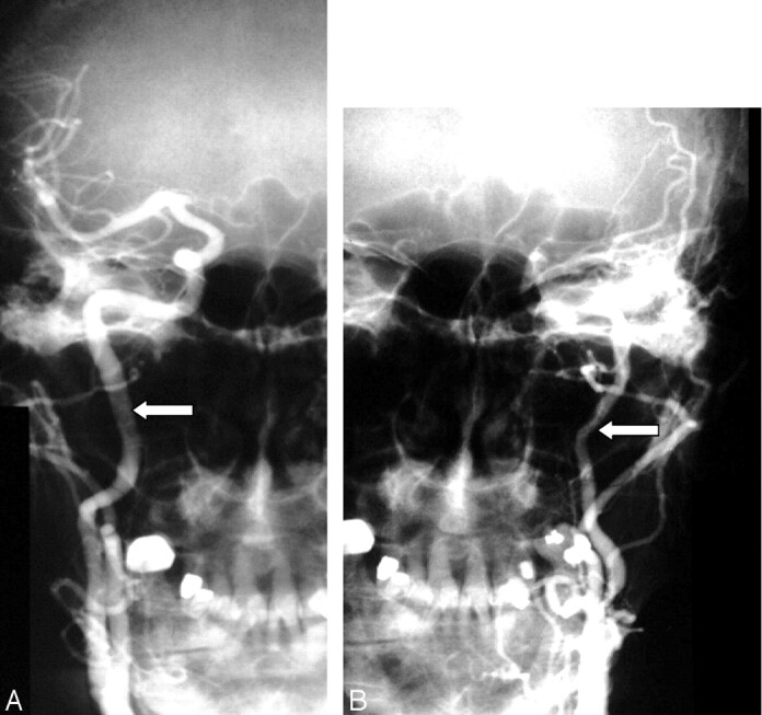 Fig 6.