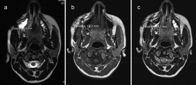 Fig. 5