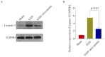 Figure 7. Caspase–3 protein expression in the hippocampus. (A) Representative western blot of Caspase–3 protein expression. (B) Densitometric analysis of Caspase–3 protein expression. Data are present...