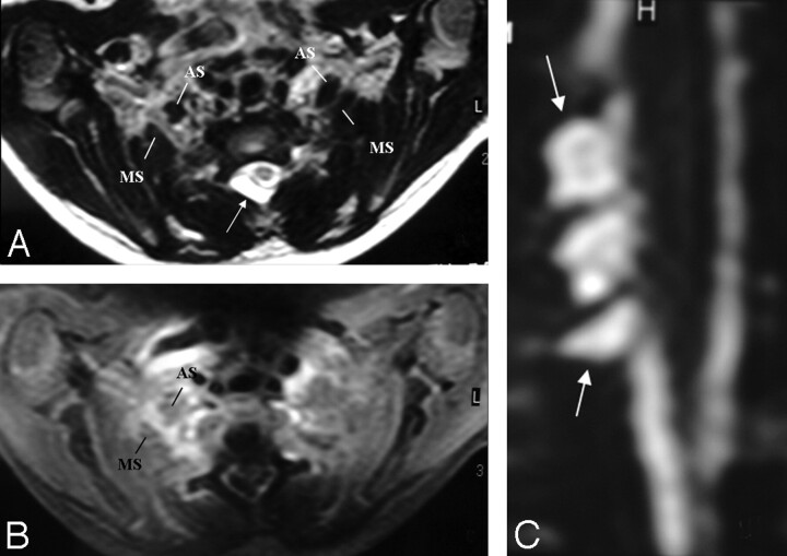 Fig 3.