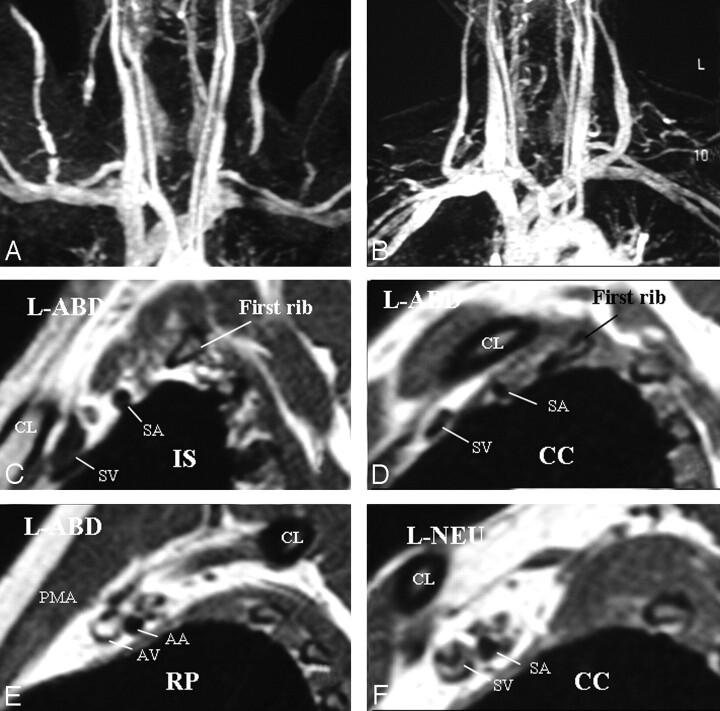 Fig 10.