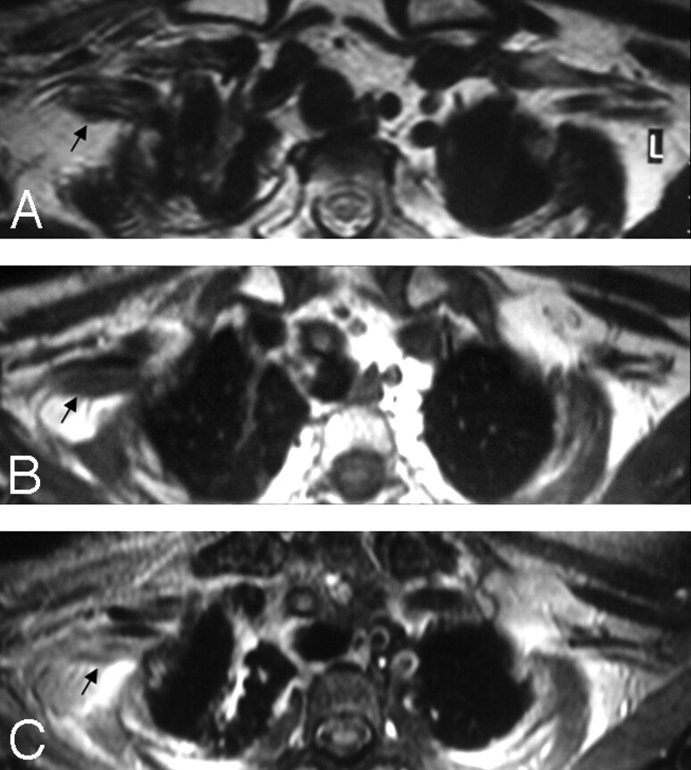 Fig 9.