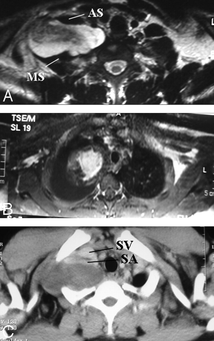 Fig 8.