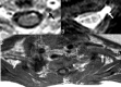 Fig 2.