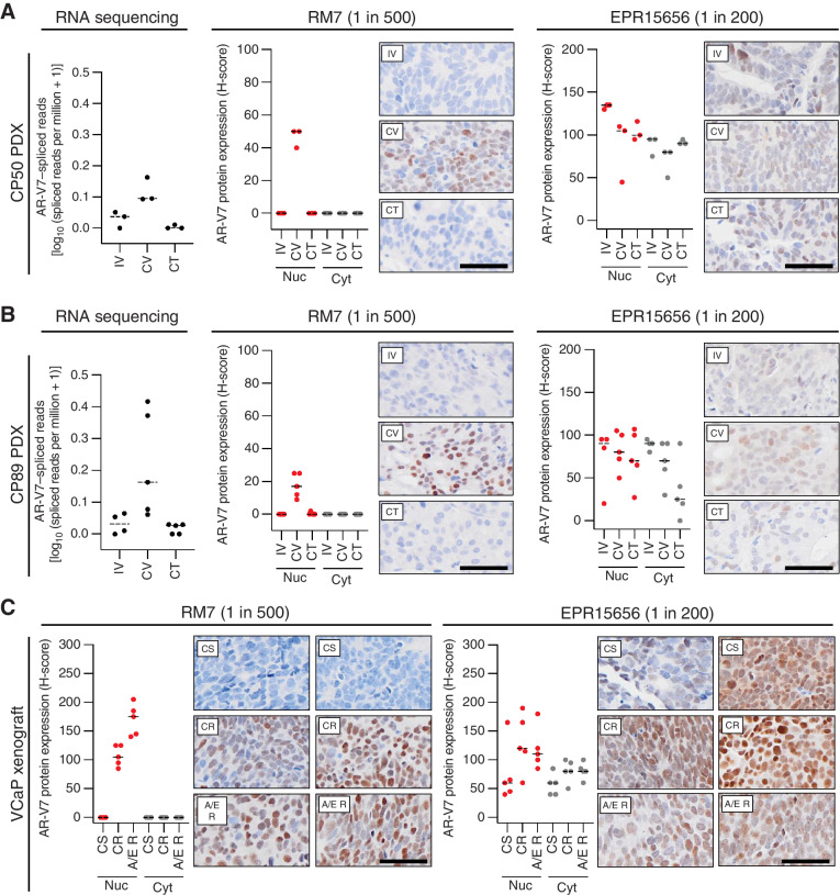 Figure 4. Comparison of AR-V7 IHC assays, and AR-V7–spliced reads from RNA analysis, in the CP50 and CP89 prostate cancer PDX, and VCaP mouse xenograft, in response to hormonal manipulation. A, For CP50 prostate cancer PDX; intact CP50 was treated with vehicle for 7 days (i.v., n = 3) and its castrate subline CP50C was treated with either vehicle (CV, n = 3) or 20 mg/kg testosterone daily (CT, n = 3) for 7 days and RNA-seq and IHC was performed. AR-V7–spliced reads (between exon 3 and cryptic exon 3) were determined from RNA-seq analysis. Spliced reads data are shown as log10 (spliced reads per million + 1). Representative micrographs of AR-V7 protein detection by IHC using EPR15656 (Abcam, 1 in 200) and RM7 (RevMAb, 1 in 500) antibodies are shown (scale bar: 50 μm). Nuclear and cytoplasmic AR-V7 staining (H-score) was determined. Line represents the median H-score. B, For CP89 prostate cancer PDX, intact CP89 was treated with vehicle for 7 days (i.v., n = 4) and its castrate subline CP89C was treated with either vehicle (CV, n = 5) or 20 mg/kg testosterone daily (CT, n = 5) for 7 days and RNA-seq and IHC was performed. AR-V7 spliced reads (between exon 3 and cryptic exon 3) were determined from RNA-seq analysis. Spliced reads data are shown as log10 (spliced reads per million + 1). Representative micrographs of AR-V7 protein detection by IHC using EPR15656 (Abcam, 1 in 200) and RM7 (RevMAb, 1 in 500) antibodies are shown (scale bar: 50 μm). Nuclear and cytoplasmic AR-V7 staining (H-score) was determined. Line represents the median H-score. C, For VCaP mouse xenografts; samples were taken from tumors that were castration-sensitive (CS, n = 5), as they progressed to CR (n = 5), and as resistance to abiraterone and enzalutamide developed (A/E R, n = 5), and IHC was performed. Representative micrographs of AR-V7 protein detection by IHC using EPR15656 (Abcam, 1 in 200) and RM7 (RevMAb, 1 in 500) antibodies are shown (scale bar: 50 μm). Nuclear and cytoplasmic AR-V7 staining (H-score) was determined. Line represents the median H-score.