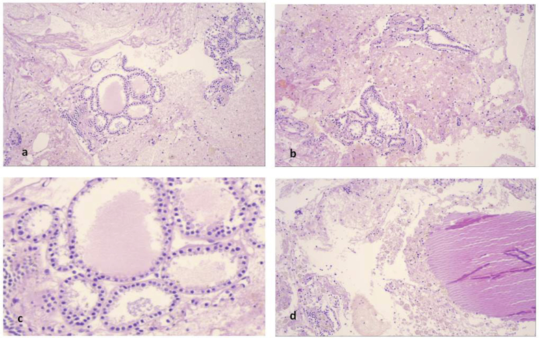 Fig. 15