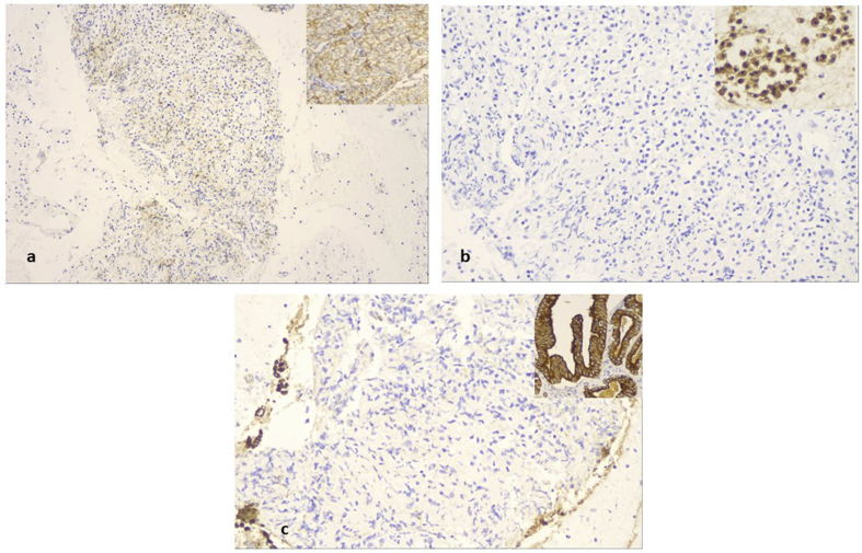 Fig. 13