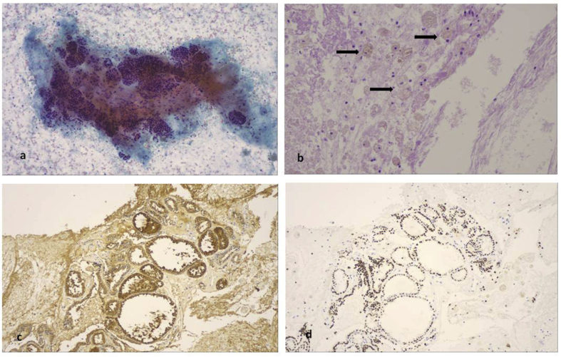 Fig. 16