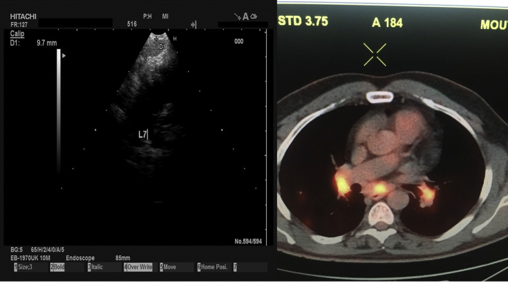 Fig. 19