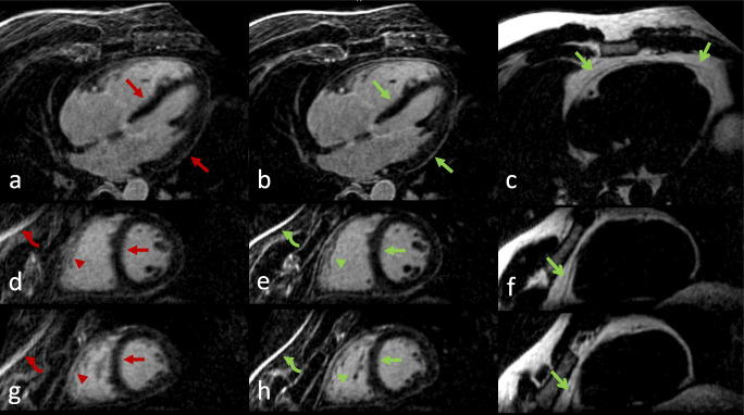 Fig. 5