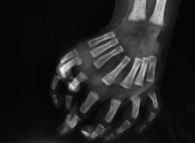 Fig. 5
