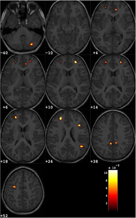 Fig. 4