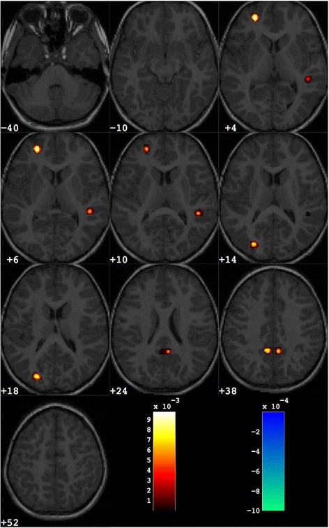 Fig. 3