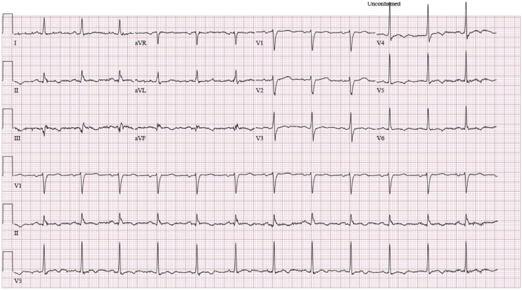 Figure 2