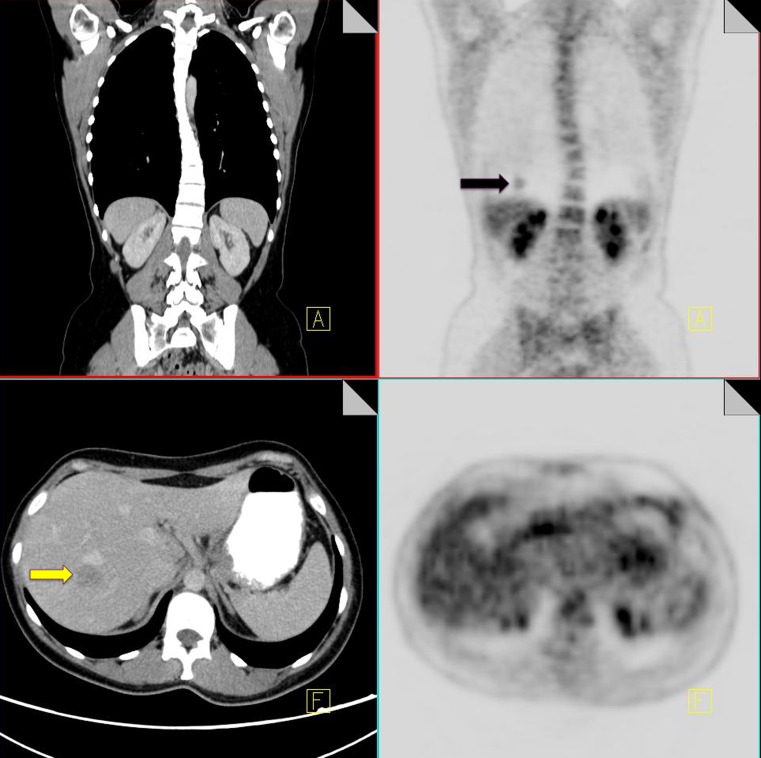 Fig. 1