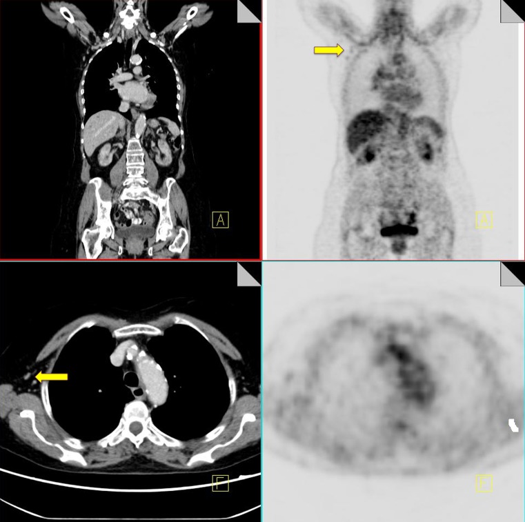 Fig. 3