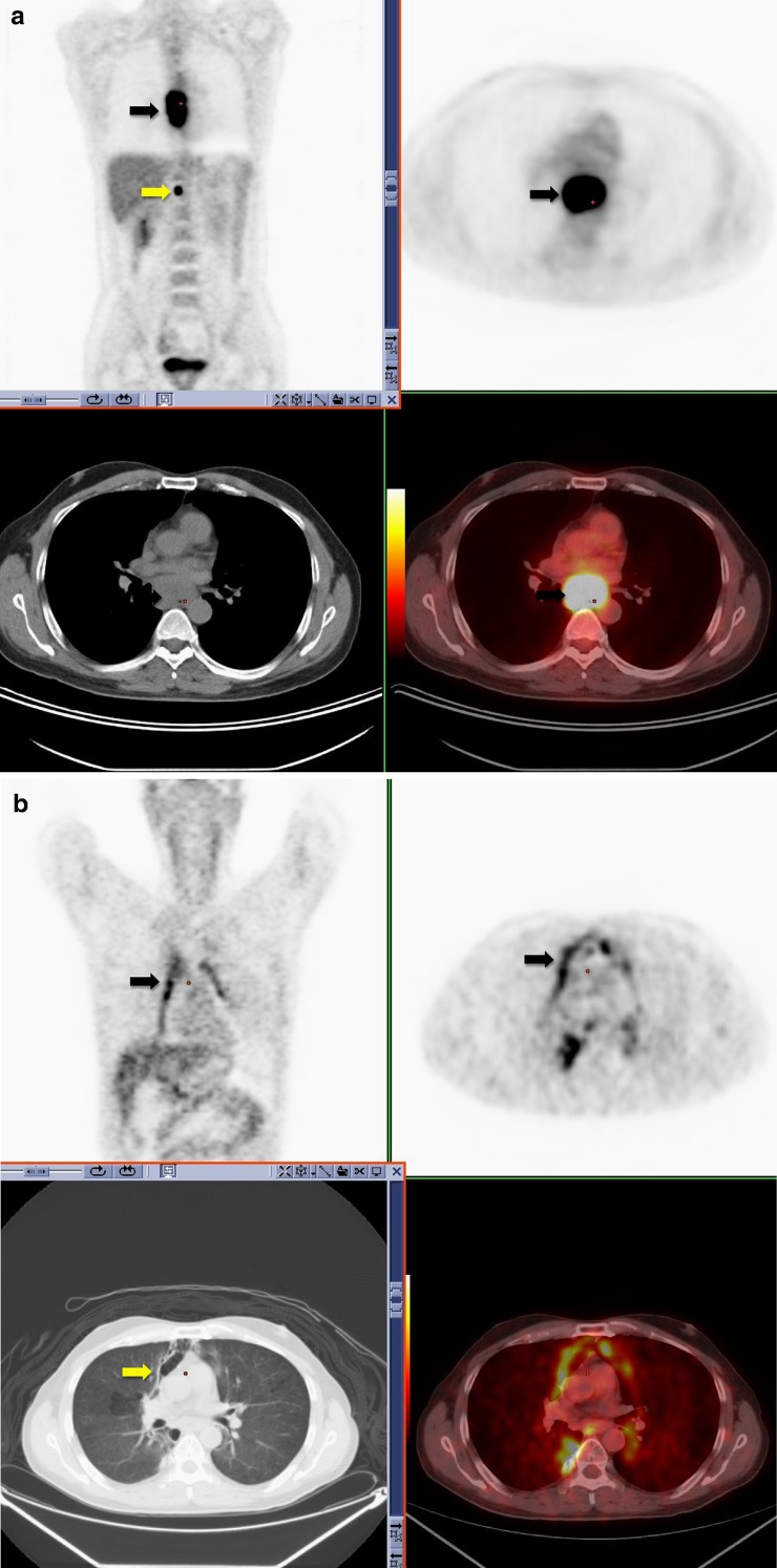 Fig. 10