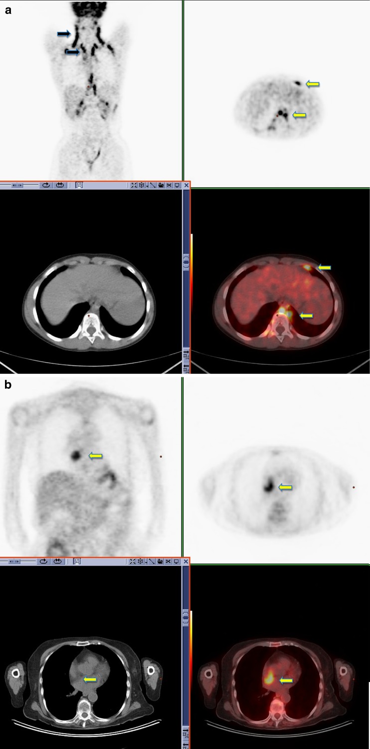 Fig. 4