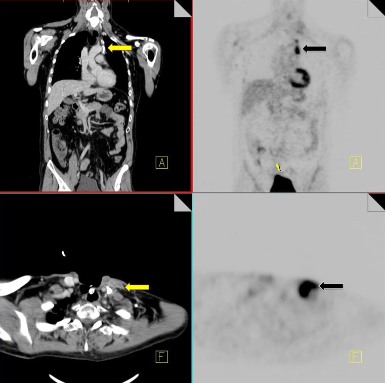 Fig. 15