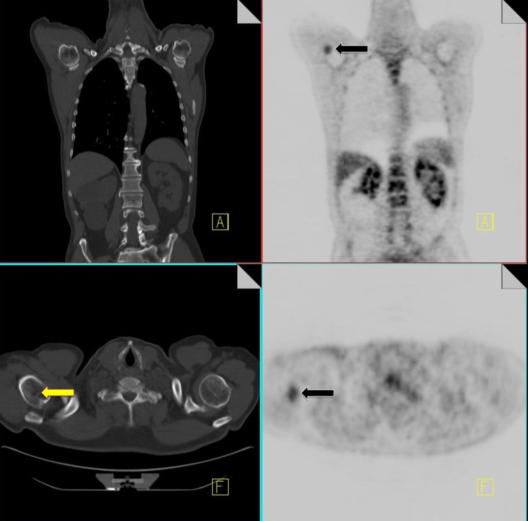 Fig. 13