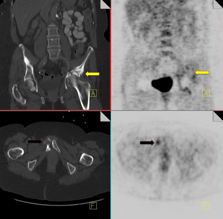 Fig. 14