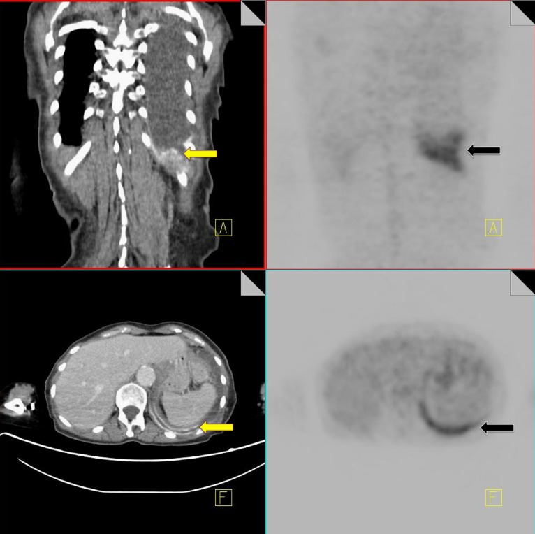 Fig. 12