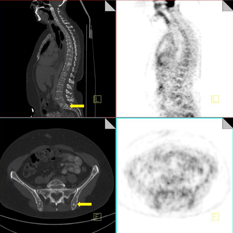 Fig. 17