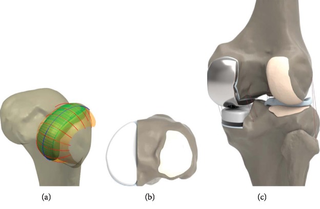 Figure 2