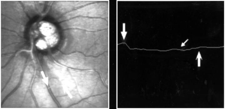 Figure 3  