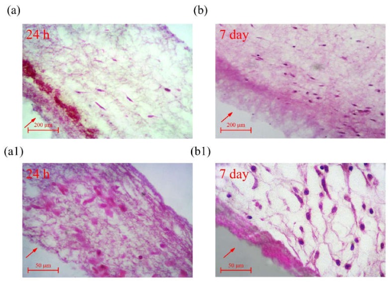 Figure 11