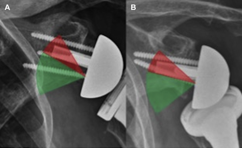 Figure 3