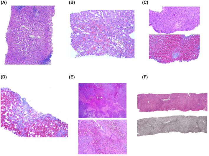 FIGURE 1