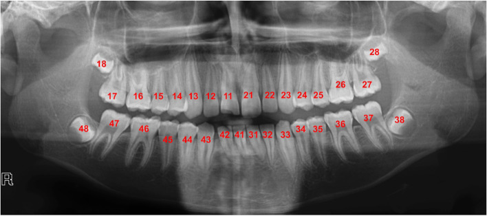 Fig. 3