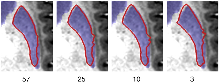 Fig. 11