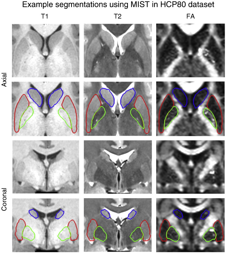 Fig. 3