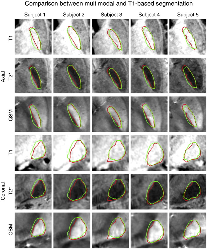 Fig. 4