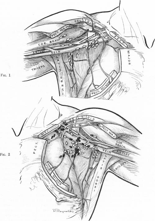 Fig. 1., Fig. 2.