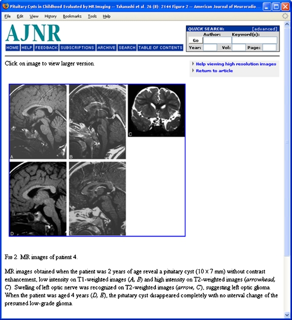 Fig 2